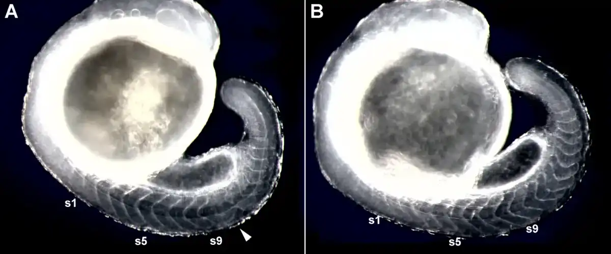 Zebravis embryo — dark-field.